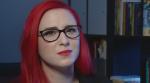 2016-04-25 Acne drug Accutane's harm to fetus a worry despite prevention efforts, CBC