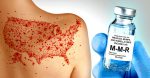 2025-02-19 Latest Measles Outbreaks a Result of Failed Vaccines — Not Failure to Vaccinate. By Sayer Ji, on CHD